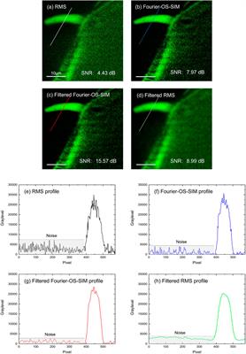 Background Noise Suppression of <mark class="highlighted">Optical Sectioning</mark> Structured Illumination Microscopy via Fourier Domain Reconstruction